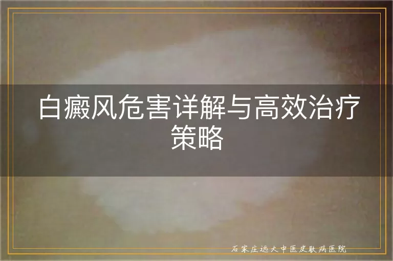 白癜风危害详解与高效治疗策略