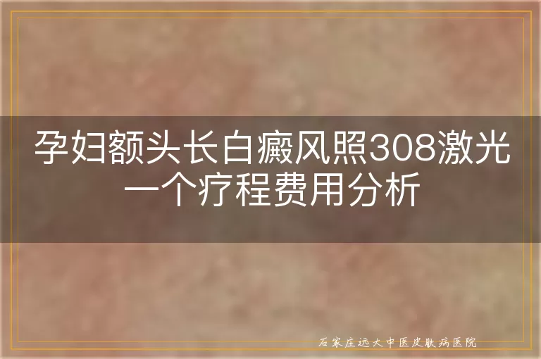 孕妇额头长白癜风照308激光一个疗程费用分析