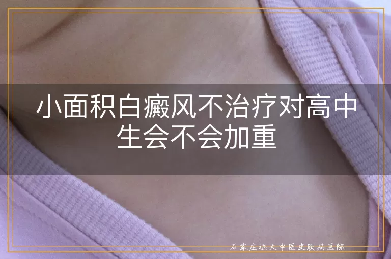 小面积白癜风不治疗对高中生会不会加重