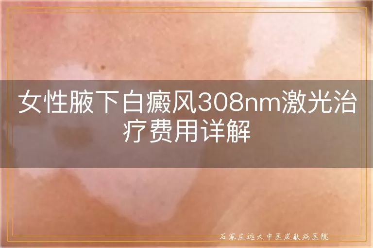 女性腋下白癜风308nm激光治疗费用详解