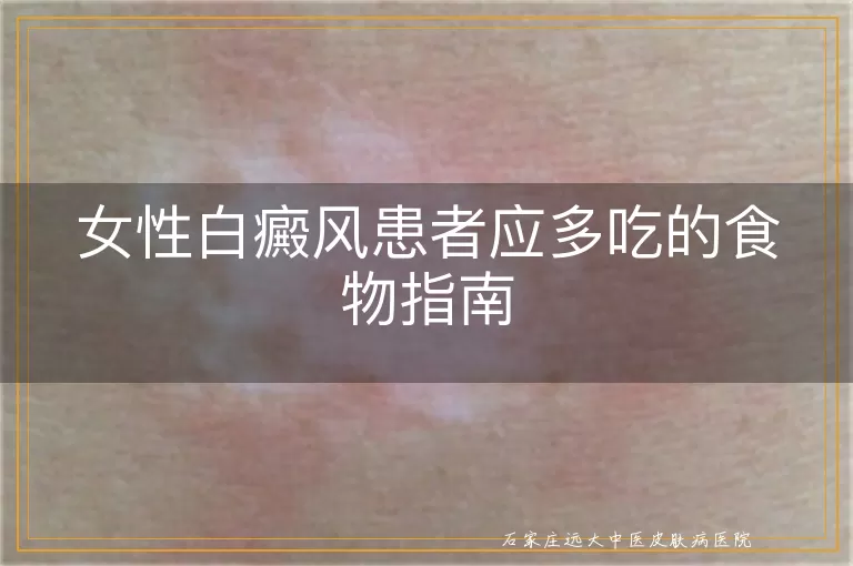 女性白癜风患者应多吃的食物指南