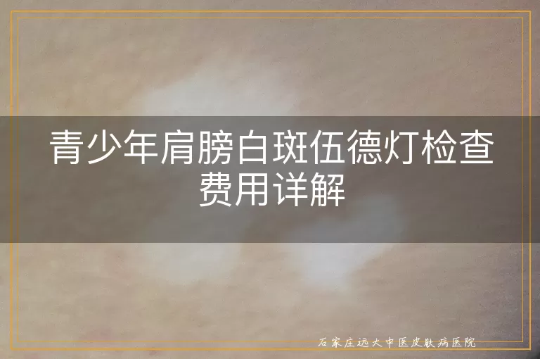 青少年肩膀白斑伍德灯检查费用详解