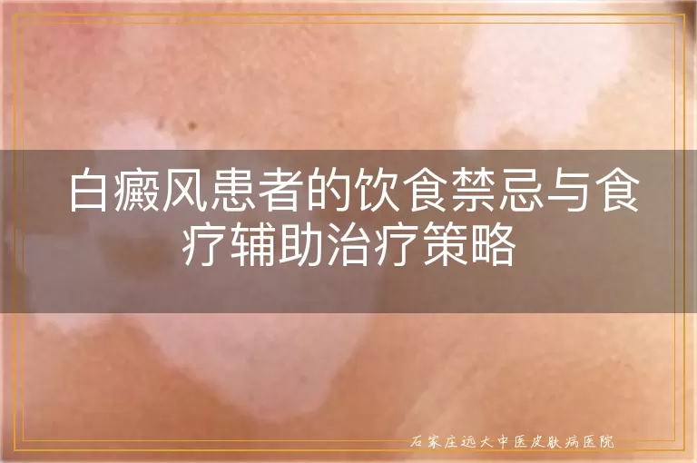 白癜风患者的饮食禁忌与食疗辅助治疗策略