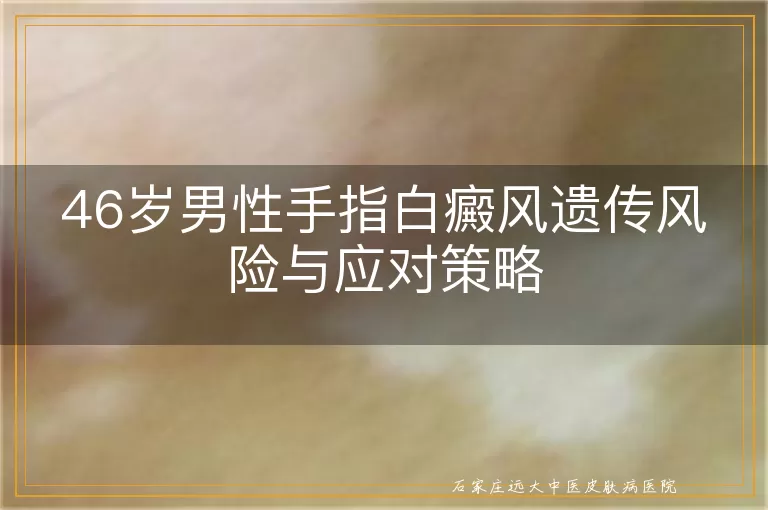 46岁男性手指白癜风遗传风险与应对策略