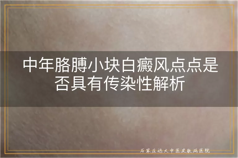 中年胳膊小块白癜风点点是否具有传染性解析