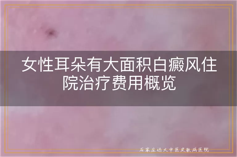 女性耳朵有大面积白癜风住院治疗费用概览