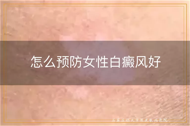 怎么预防女性白癜风好