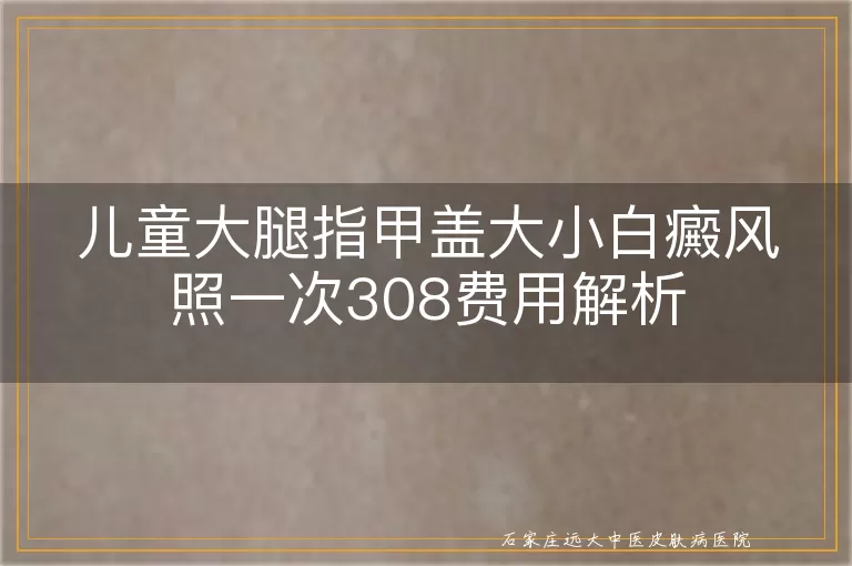 儿童大腿指甲盖大小白癜风照一次308费用解析