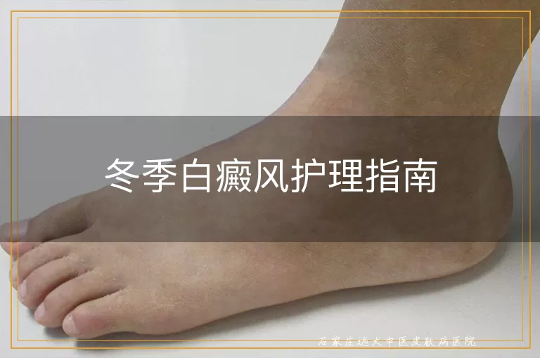 冬季白癜风护理指南