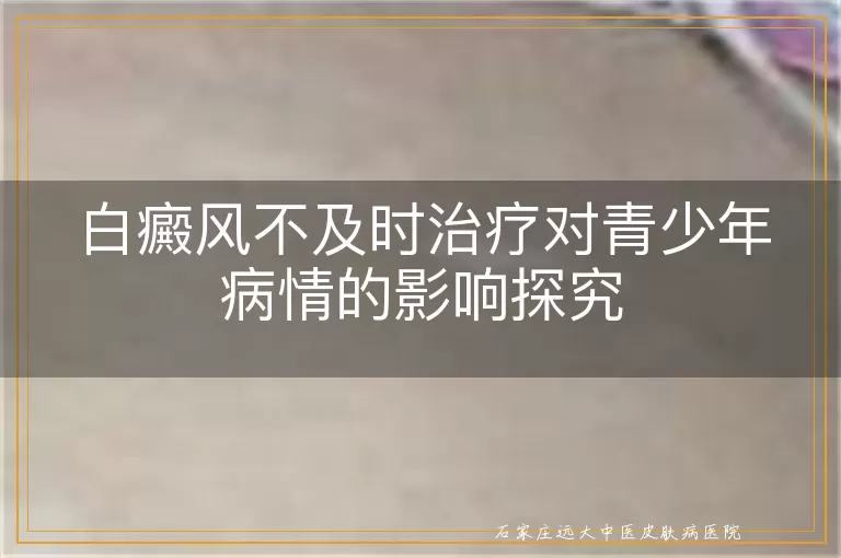 白癜风不及时治疗对青少年病情的影响探究