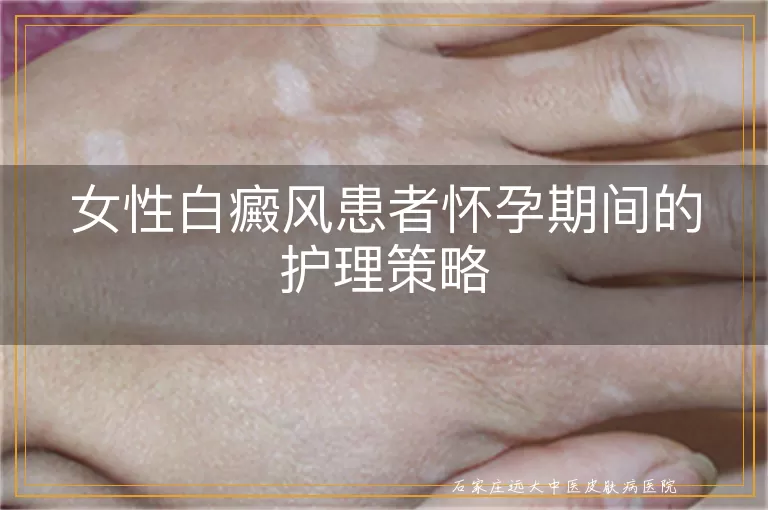 女性白癜风患者怀孕期间的护理策略