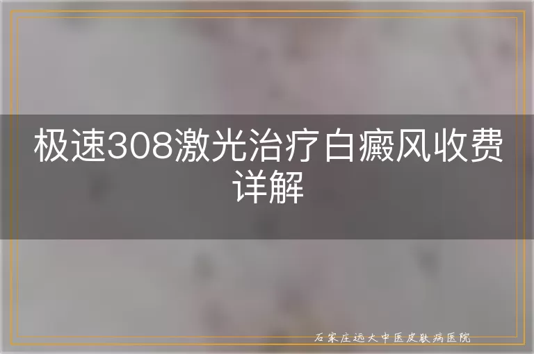 极速308激光治疗白癜风收费详解