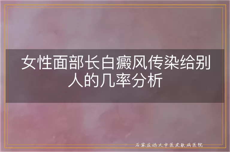 女性面部长白癜风传染给别人的几率分析