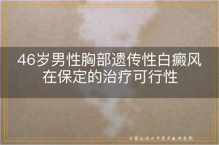46岁男性胸部遗传性白癜风在保定的治疗可行性