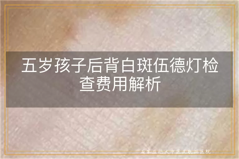 五岁孩子后背白斑伍德灯检查费用解析