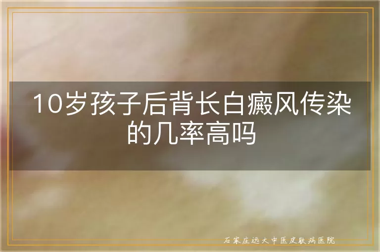10岁孩子后背长白癜风传染的几率高吗