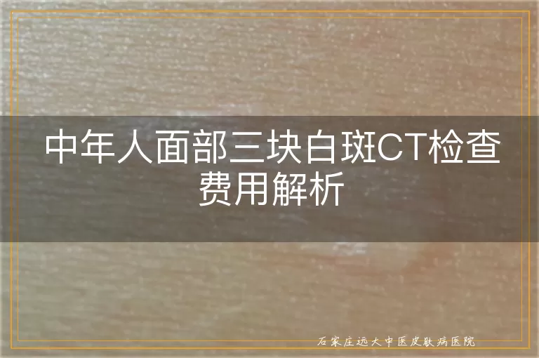中年人面部三块白斑CT检查费用解析