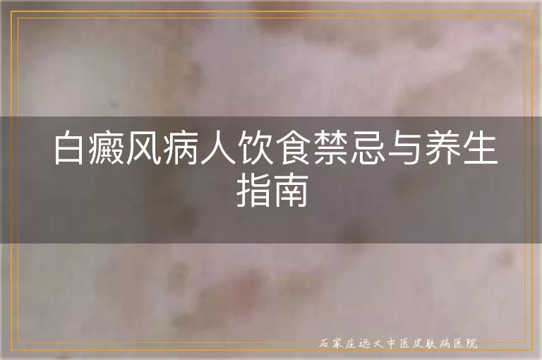 白癜风病人饮食禁忌与养生指南