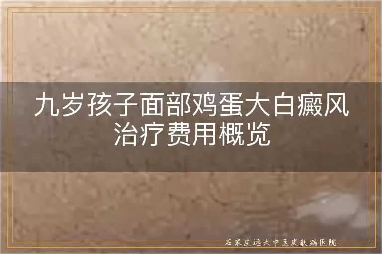 九岁孩子面部鸡蛋大白癜风治疗费用概览