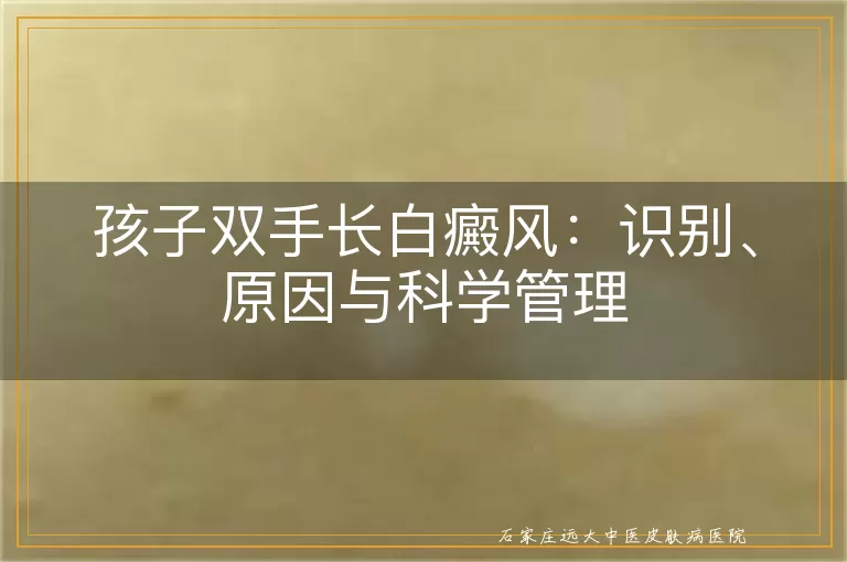 孩子双手长白癜风：识别、原因与科学管理