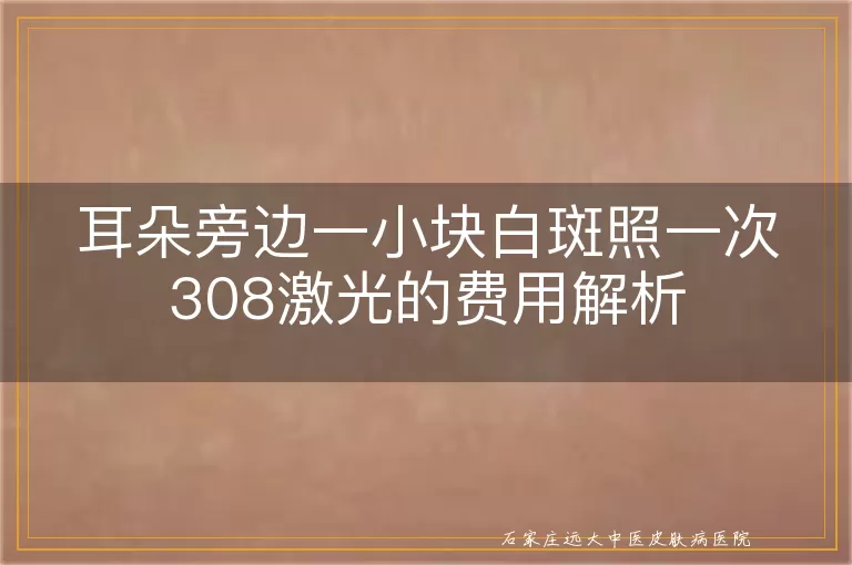 耳朵旁边一小块白斑照一次308激光的费用解析