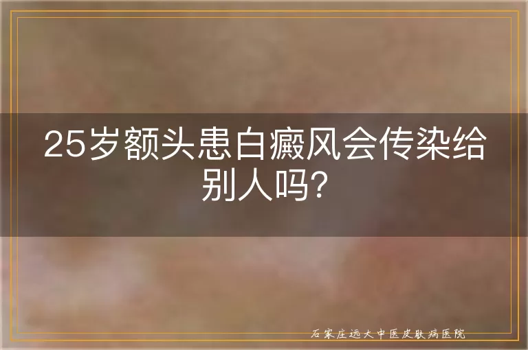25岁额头患白癜风会传染给别人吗？