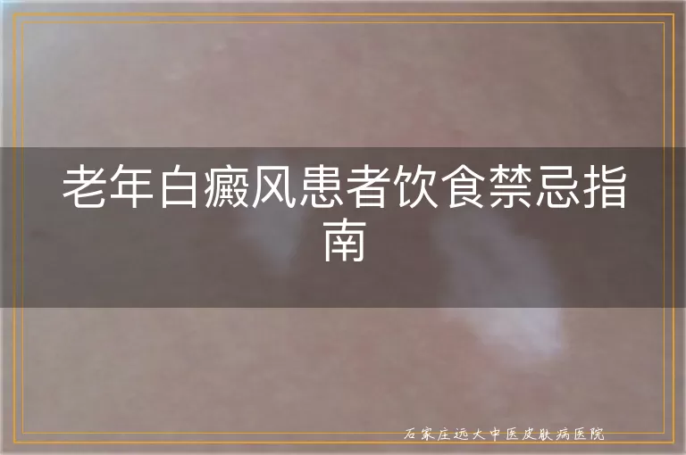 老年白癜风患者饮食禁忌指南