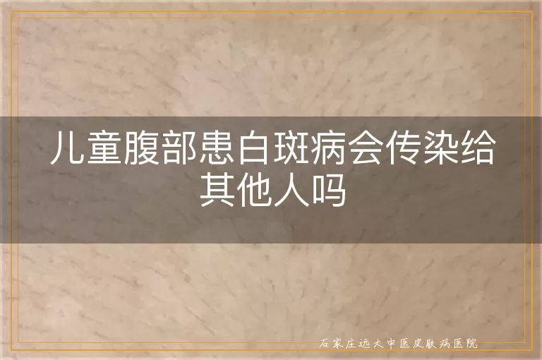 儿童腹部患白斑病会传染给其他人吗
