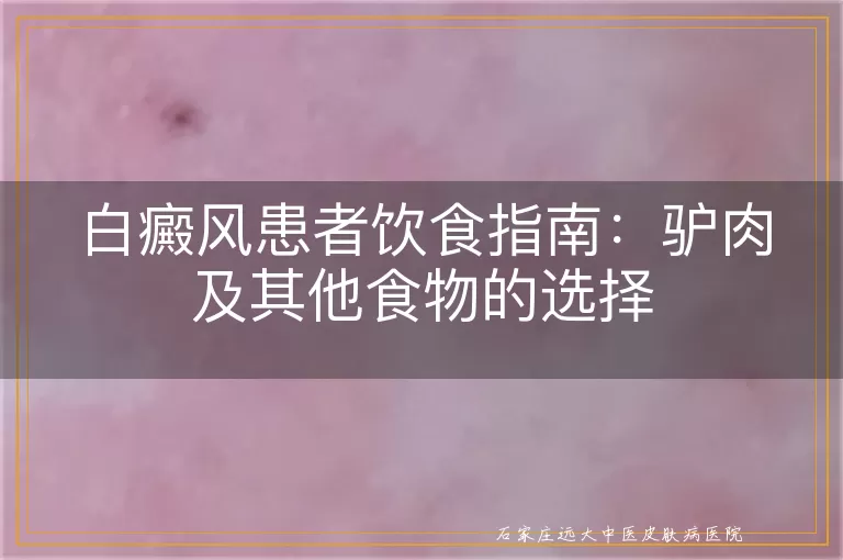 白癜风患者饮食指南：驴肉及其他食物的选择