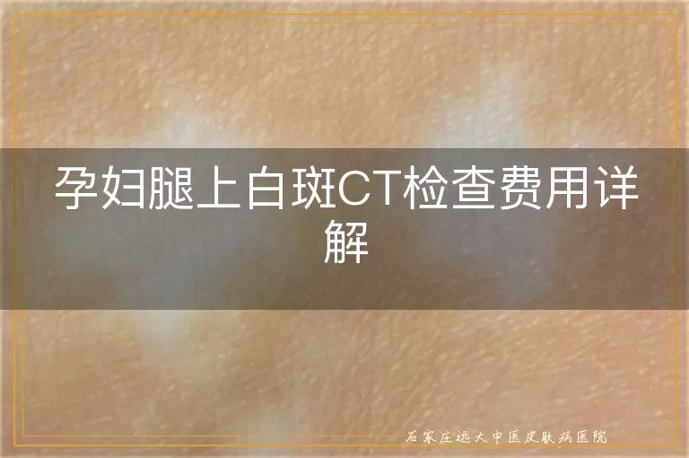 孕妇腿上白斑CT检查费用详解