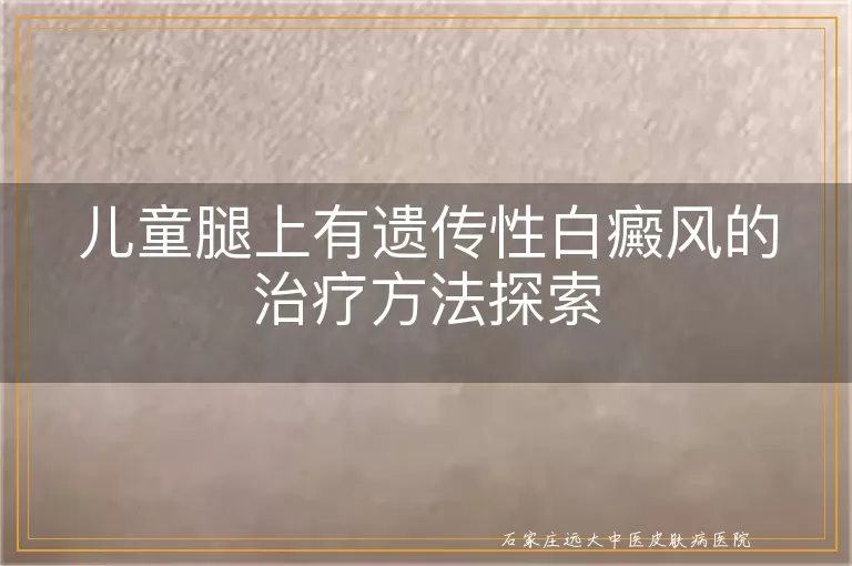 儿童腿上有遗传性白癜风的治疗方法探索