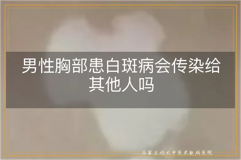男性胸部患白斑病会传染给其他人吗