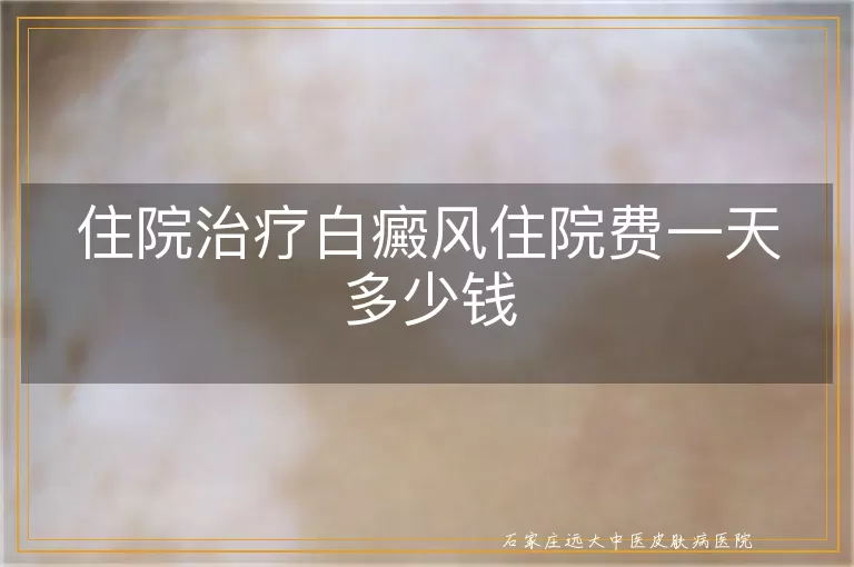 住院治疗白癜风住院费一天多少钱