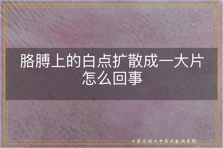 胳膊上的白点扩散成一大片怎么回事