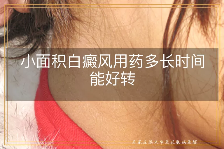 小面积白癜风用药多长时间能好转