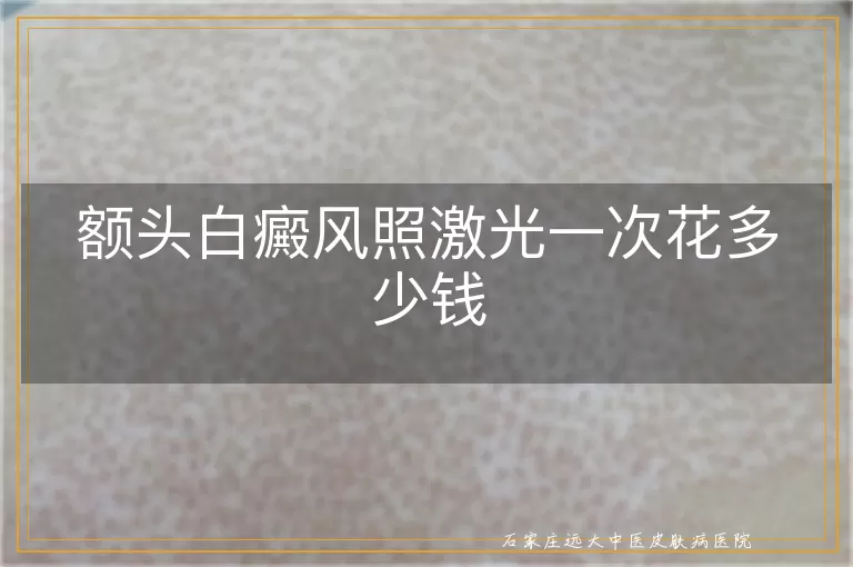 额头白癜风照激光一次花多少钱