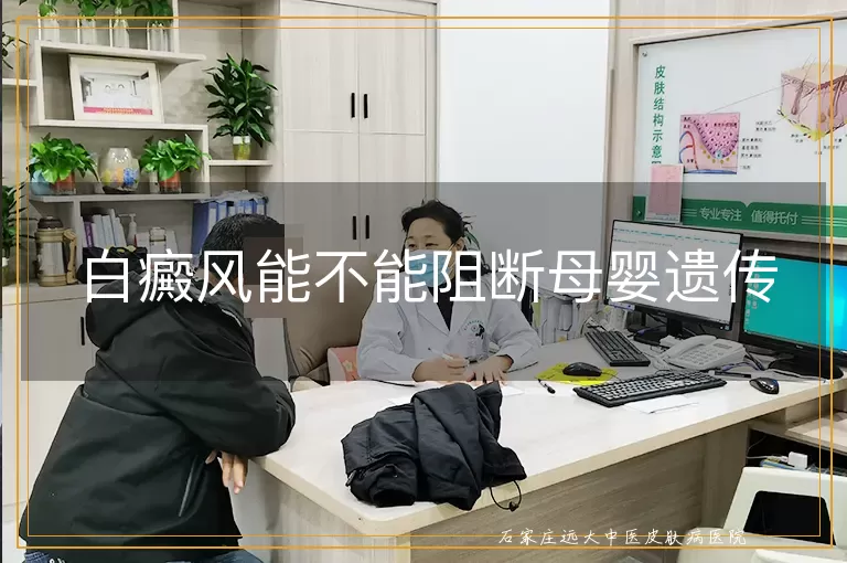 白癜风能不能阻断母婴遗传