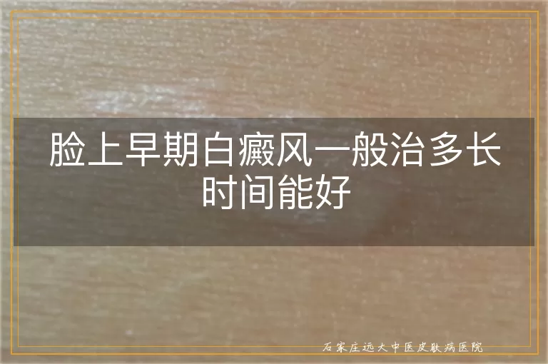 脸上早期白癜风一般治多长时间能好