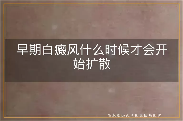 早期白癜风什么时候才会开始扩散