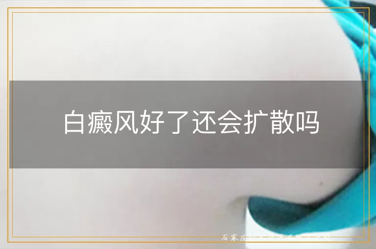白癜风好了还会扩散吗