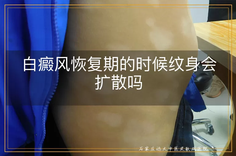 白癜风恢复期的时候纹身会扩散吗
