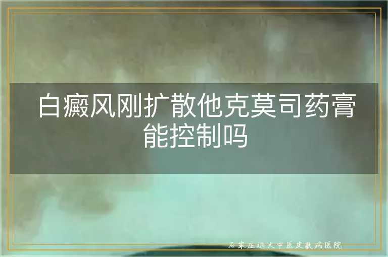 白癜风刚扩散他克莫司药膏能控制吗