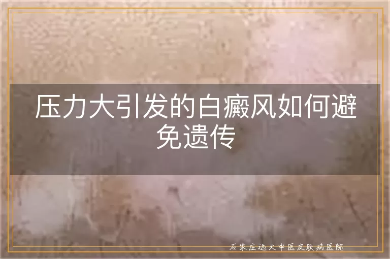压力大引发的白癜风如何避免遗传