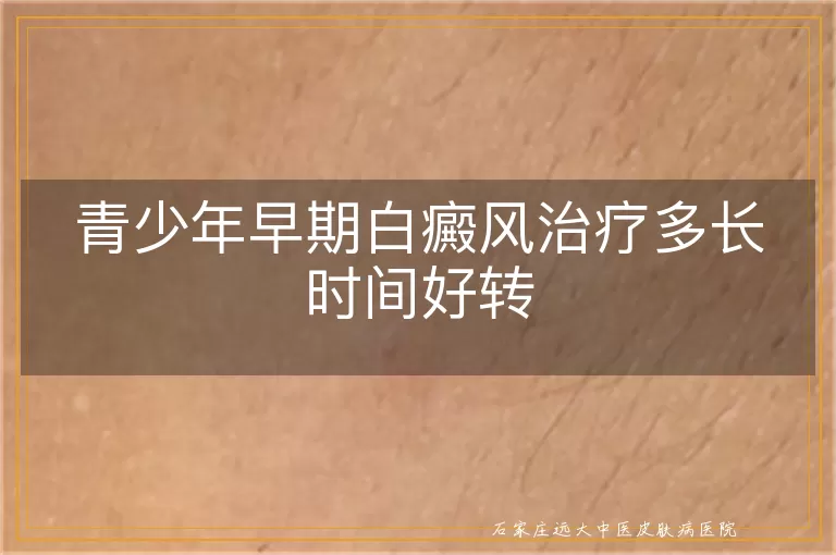 青少年早期白癜风治疗多长时间好转