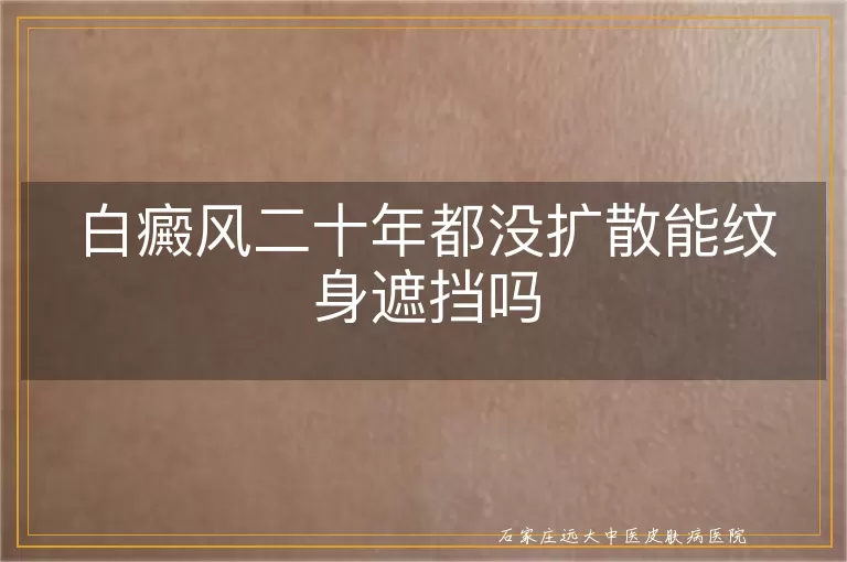 白癜风二十年都没扩散能纹身遮挡吗