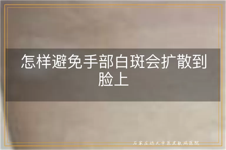 怎样避免手部白斑会扩散到脸上