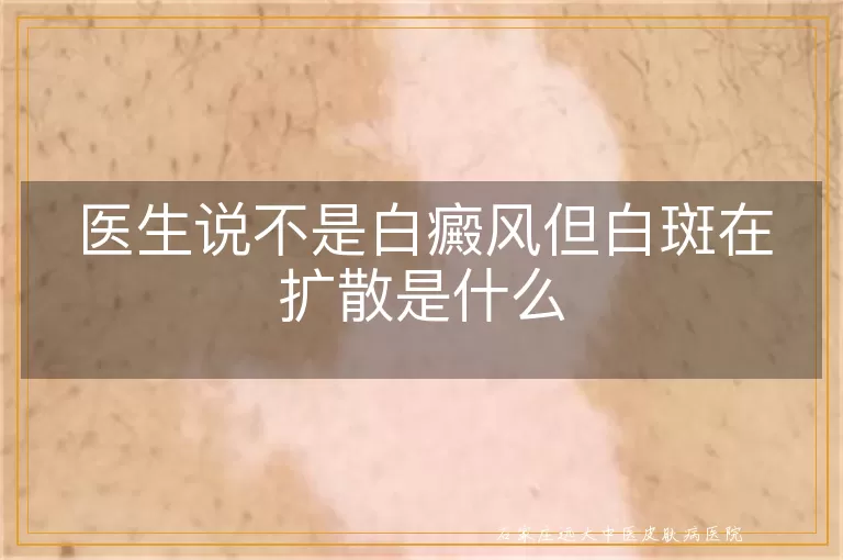 医生说不是白癜风但白斑在扩散是什么