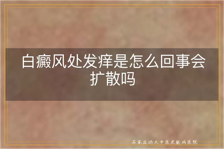 白癜风处发痒是怎么回事会扩散吗