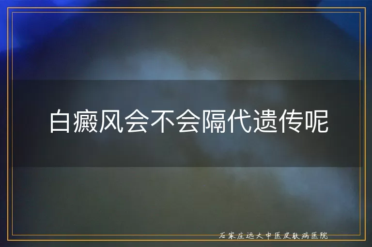 白癜风会不会隔代遗传呢