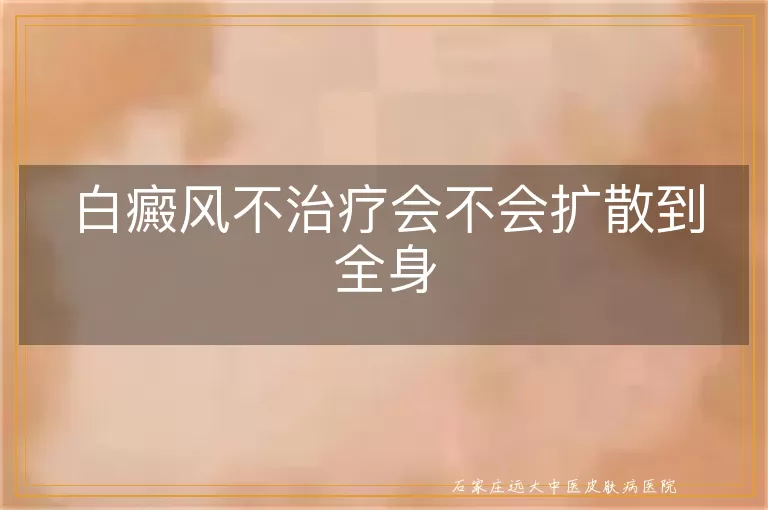 白癜风不治疗会不会扩散到全身
